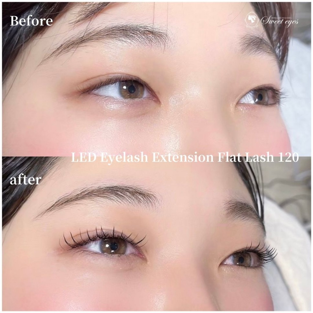 ビフォーアフターの仕上がりが綺麗でとても満足ですカウンセリングが丁寧♪