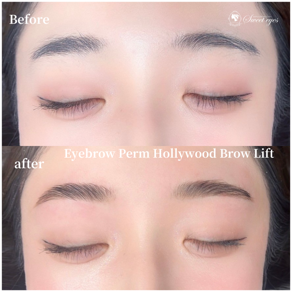 初めてでしたが凄く丁寧なカウンセリングで安心♪