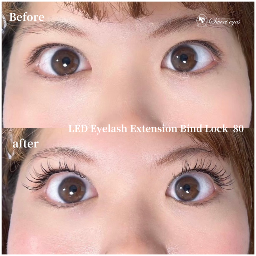 デザインなど詳しく相談して提案してくれるので凄く安心して施術を受けれました♪