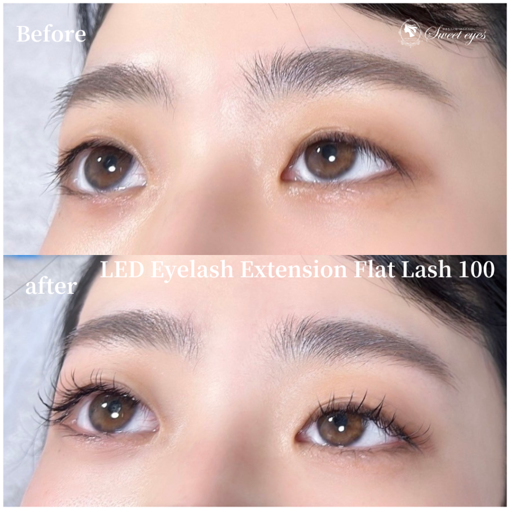 LEDで長持ち！価格も安い！駅も近い！仕上がり綺麗！カウンセリング親身！