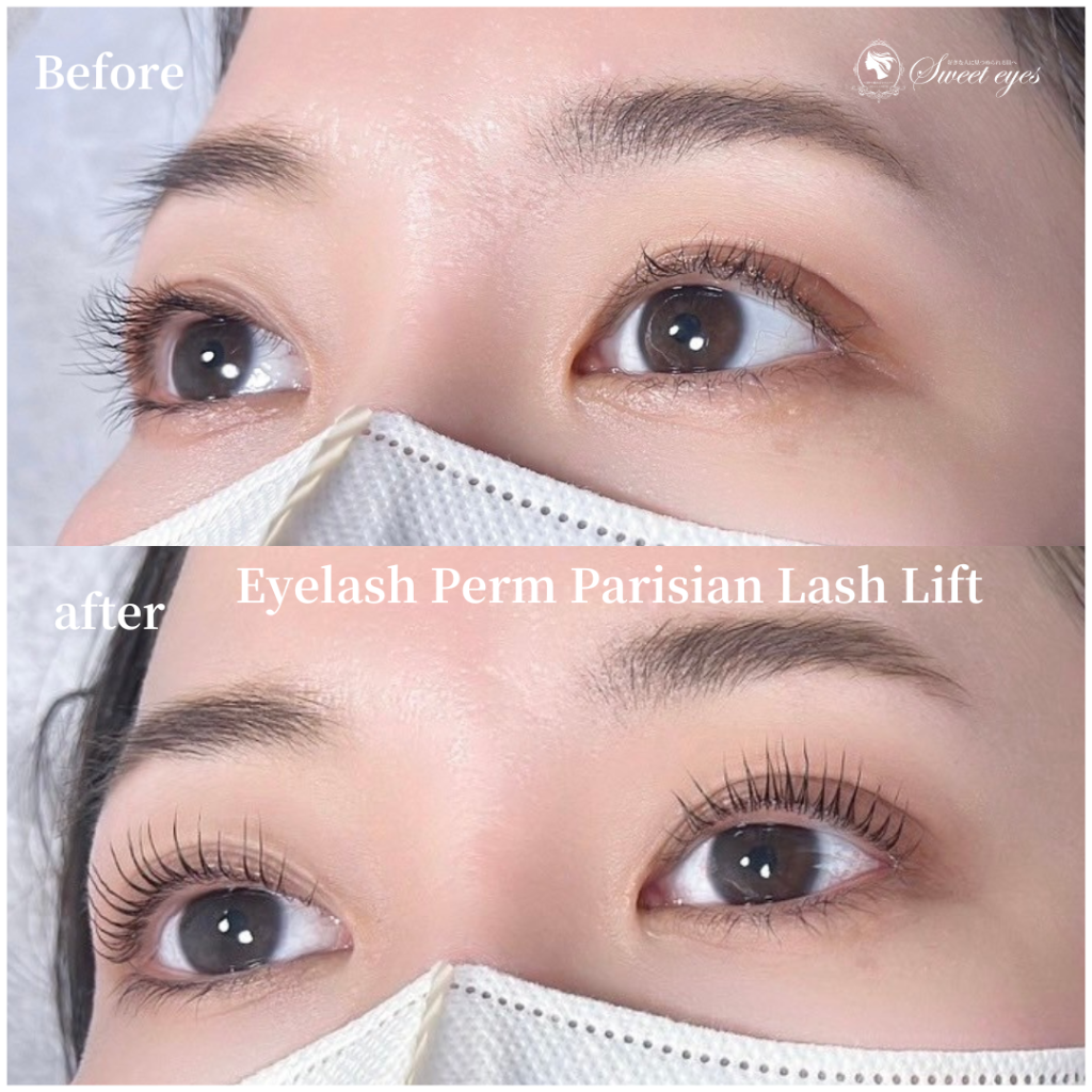 LED初めてで長持ちすると口コミを見たので楽しみで来店しました♪