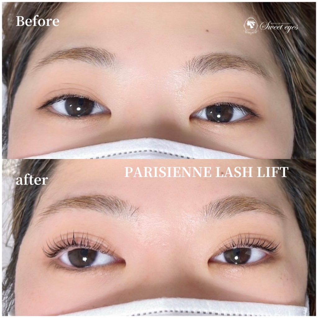 他の店舗さんの価格が高かったり効果をあまり感じられなかったので選びました