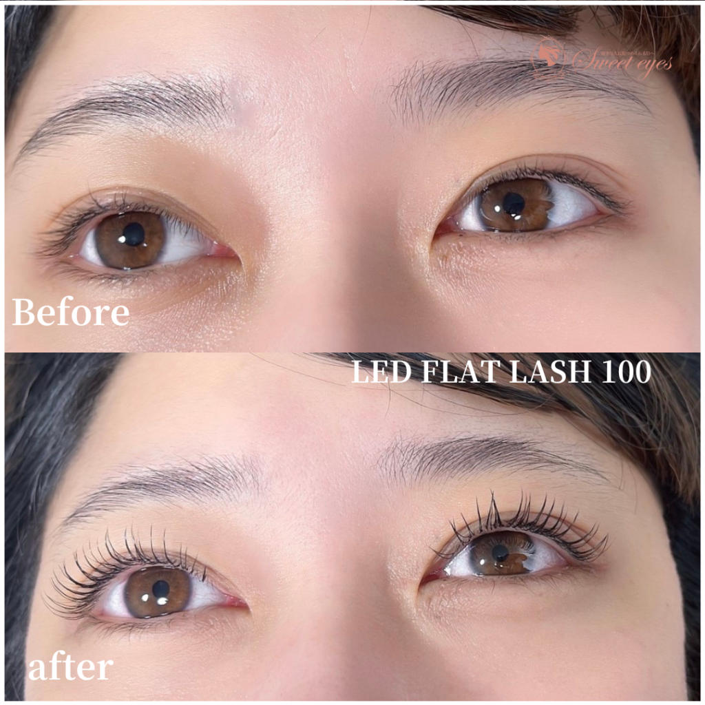 最初全然分かりませんでしたが、施術者さんがとても丁寧に 色々教えてくれて