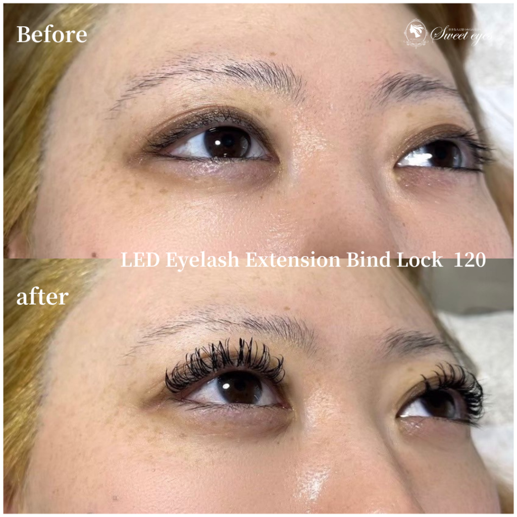 普通のマツエクだと直ぐに取れてしまう目の痒みも何とかしたい！